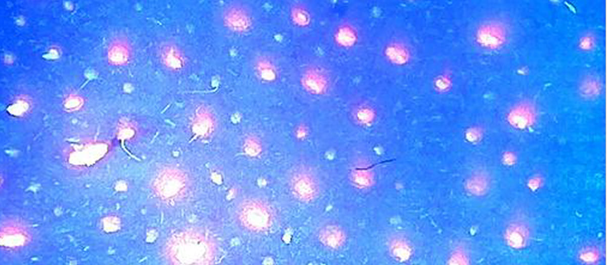 TRANSCOL BUBBLE H-10