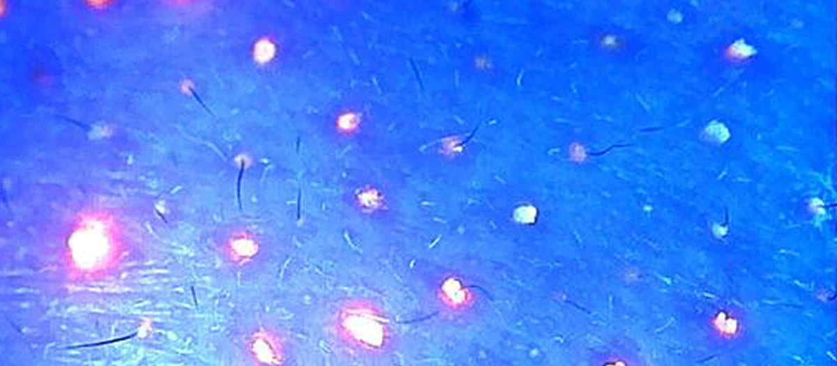 TRANSCOL BUBBLE H-11